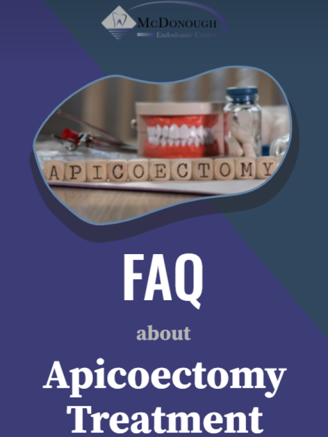 What is an Apicoectomy?